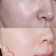 Гиалуроновая сыворотка SKIN1004 Madagascar Centella Hyalu-Cica Blue Serum с центеллой азиатской 30 мл - изображение 5