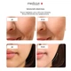 Массажер для лица Medica+ SkinLifting PRO 10X с RF-лифтингом, микрострумами и LED-терапией - изображение 7