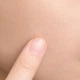 SKIN 1004 Патчі ультратонкі проти висипань Spot Cover Patch 22 шт - изображение 6
