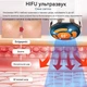 Аппарат V-Lift Pro 4D для лифтинга лица HIFU RF EMS 4-в-1 - изображение 7