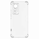 Чехол XON PhoneCase для Xiaomi Mi 12 Lite (PCSA3111201T 0489) Прозрачный - изображение 1