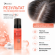 Пенный кислотный пилинг для кожи головы SOIKA Foam Peeling PRO с салициловой кислотой 150 мл - изображение 5