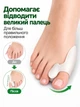 Силиконовый протектор на косточку Valgus Pro с перегородкой 1 пара (24052011) - изображение 6