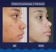 Пенка для умывания от акне для лица и тела PanOxyl Acne Foaming Wash for Face Body 28 г - изображение 7