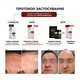 Осветляющий крем BRADERM Tramexal Cream, 30 мл 00-00000388 - изображение 2