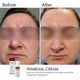 Осветляющий крем BRADERM Tramexal Cream, 30 мл 00-00000388 - изображение 4