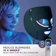 LED-маска для обличчя Shark CryoGlow FW312UK Blue Frost [177983] - зображення 10
