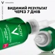 Сыворотка-пилинг Vichy Normaderm для коррекции недостатков жирной и проблемной кожи лица 30 мл (3337875791984) - изображение 6