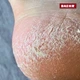 Крем для ніг PEDIBAEHR Rose Cream з 10% сечовиною, для дуже сухої та потрісканої шкіри стоп, інтенсивне зволоження та пом'якшення, з маслом Ши та шипшини, 125 мл - зображення 3