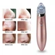 Вакуумный очиститель кожи Menqahahayd XN-8030 Pink - изображение 5