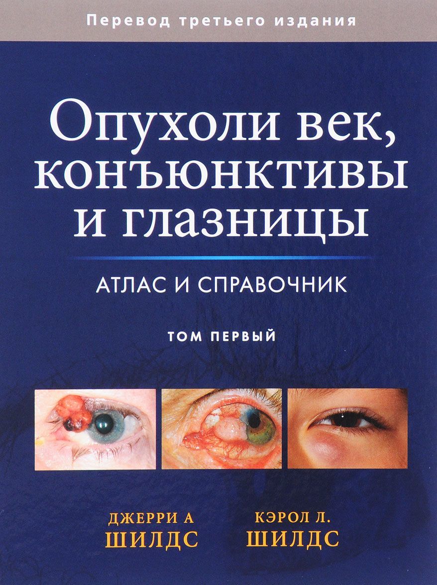 

Опухоли век, конъюнктивы и глазницы. Атлас и справочник. В 2 томах. Том 1 (1613350)