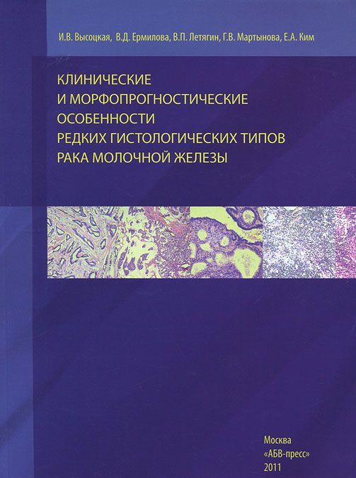 

Клинические и морфопрогностические особенности редких гистологических типов рака молочной железы