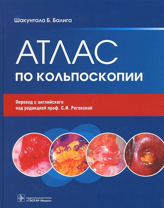 

Атлас по кольпоскопии