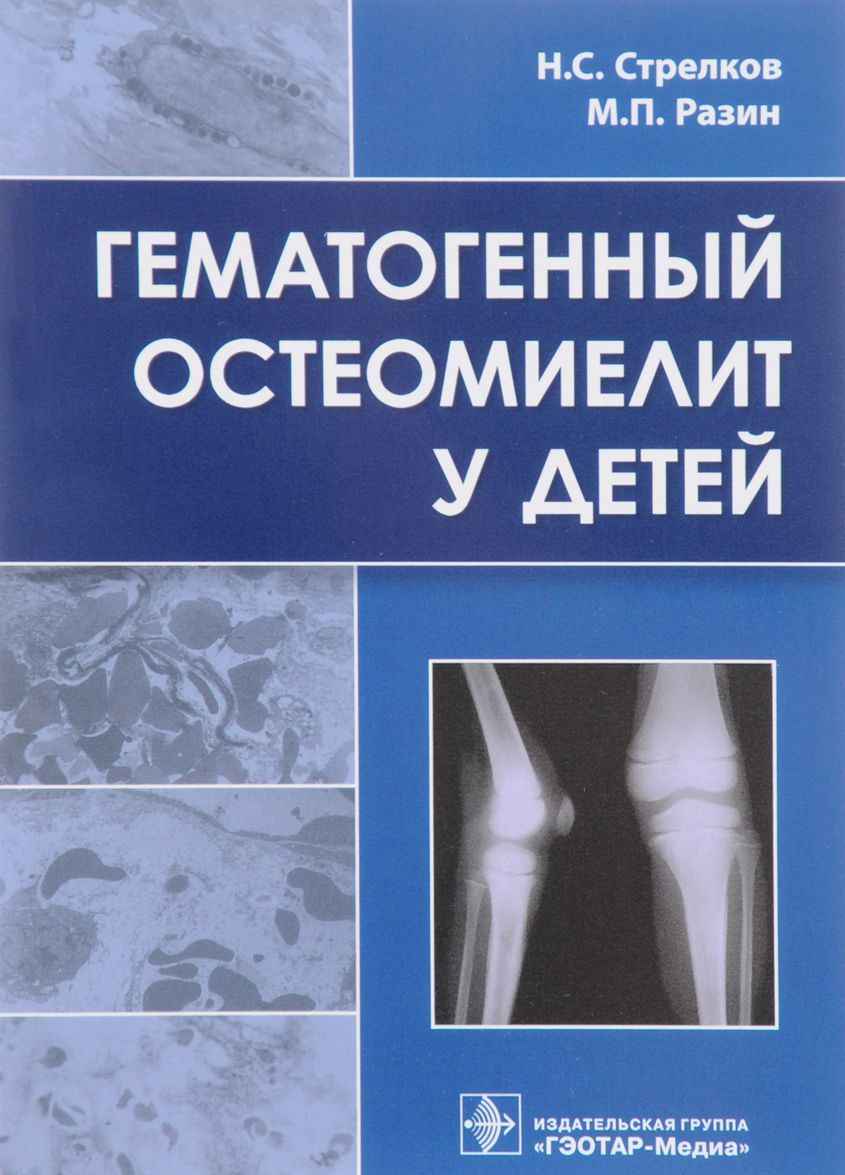 

Гематогенный остеомиелит у детей