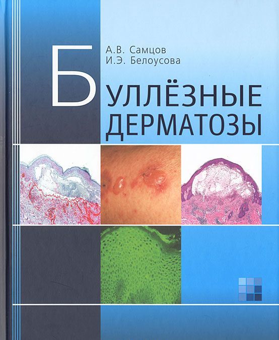 

Буллёзные дерматозы. Монография