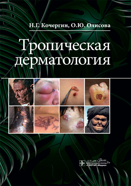 

Тропическая дерматология