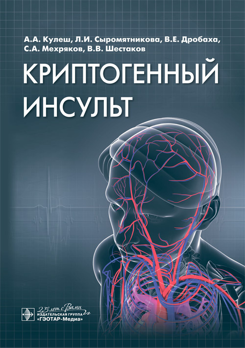 

Криптогенный инсульт