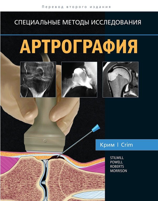 

Артрография