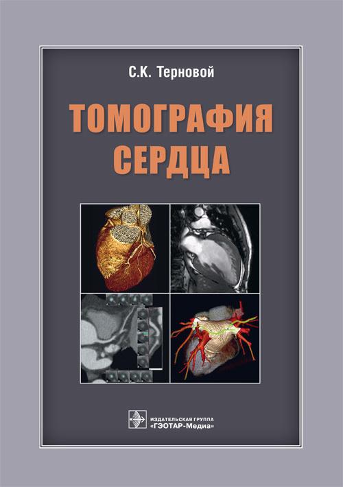 

Терновой, Белькинд, Веселова: Томография сердца. Руководство для врачей