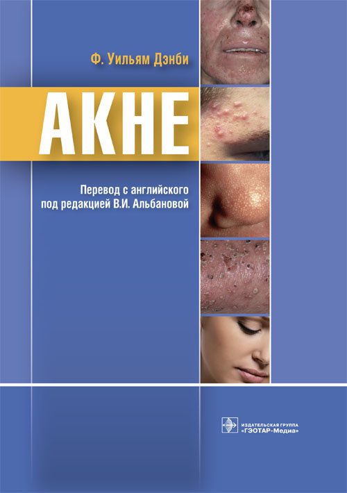 

Ф. Дэнби: Акне