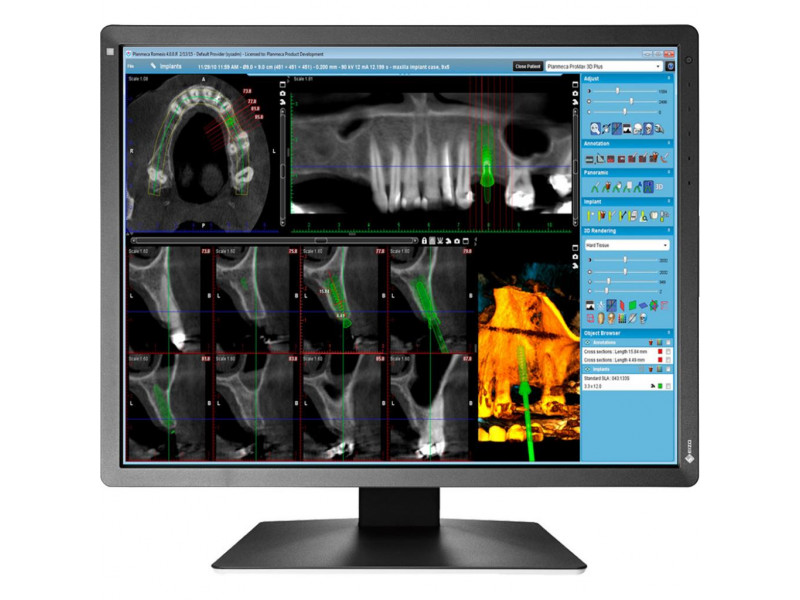

Монитор Eizo MX216-SB RadiForce