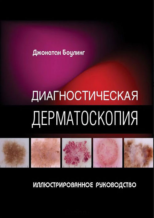 Диагностическая дерматоскопия. Иллюстрированное руководство - Боулинг Дж. (978-5-91839-106-8)