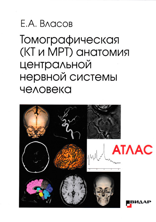

Томографическая (КТ и МРТ) анатомия центральной нервной системы человека. Атлас - Е.А.Власов (978-5-88429-255-0)