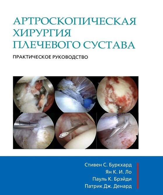 

Артроскопическая хирургия плечевого сустава. Практическое руководство - Буркхардт С.С. и другие (978-5-91839-054-2)
