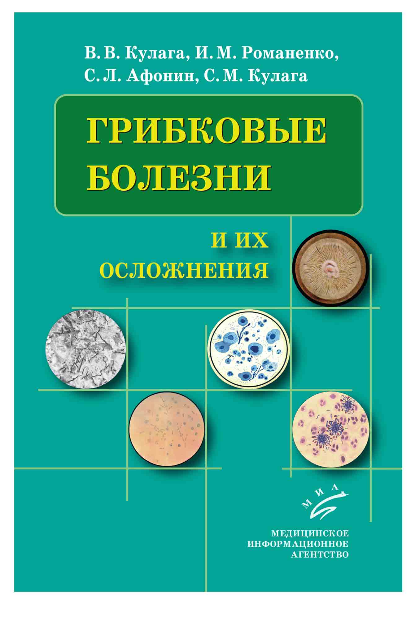 

Грибковые болезни и их осложнения - Кулага В.В., Романенко И.М. (978-5-8948-1849-8)