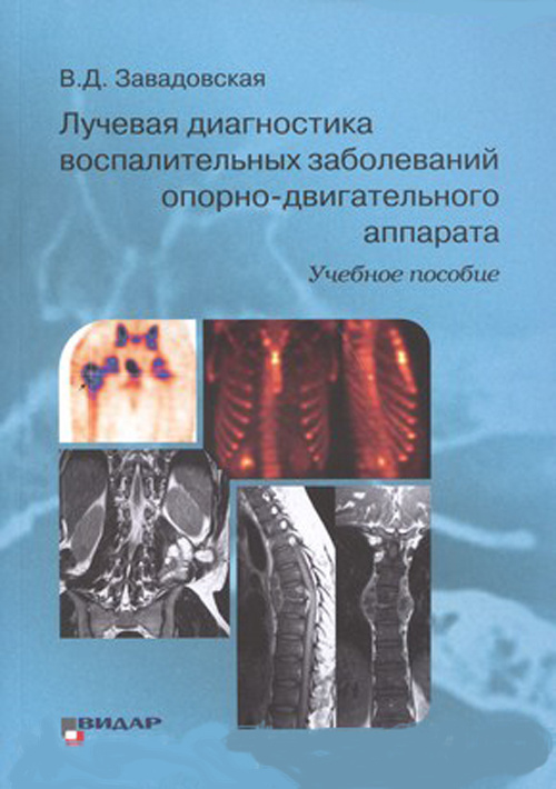 

Лучевая диагностика воспалительных заболеваний опорно-двигательного аппарата - В.Д. Завадовская (978-5-88429-245-1)