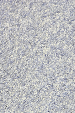 

Жидкие обои Bioplast синие 874