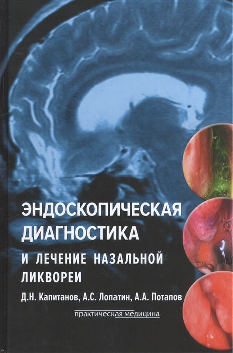 

Эндоскопическая диагностика и лечение назальной ликвореи. Руководство