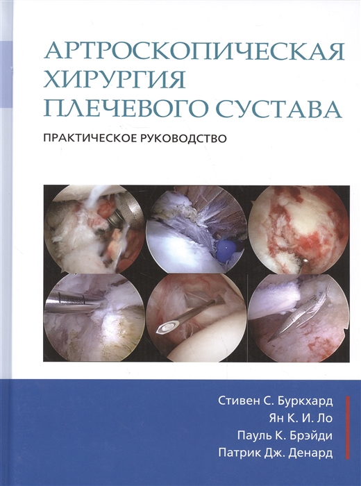 

Артроскопическая хирургия плечвого сустава. Практическое руководство