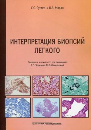 

Интерпретация биопсий легкого (4300148)