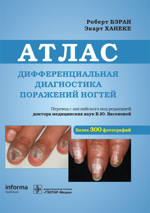

Дифференциальная диагностика поражений ногтей. Атлас (4289657)