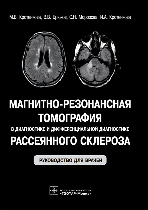 

Магнитно-резонансная томография в диагностике и дифференциальной диагностике рассеянного склероза. Руководство для врачей