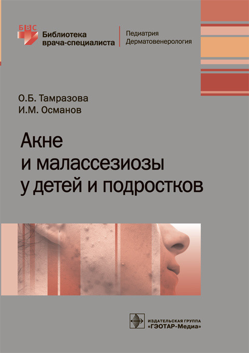 

Акне и малассезиозы у детей и подростков (1758492)