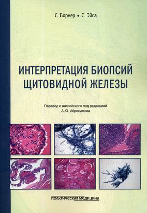 

Интерпретация биопсий щитовидной железы (4289247)