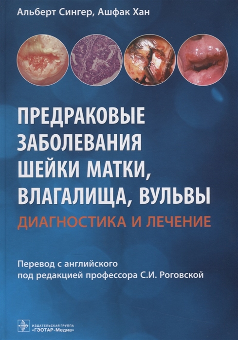 

Предраковые заболевания шейки матки, влагалища, вульвы. Диагностика и лечение