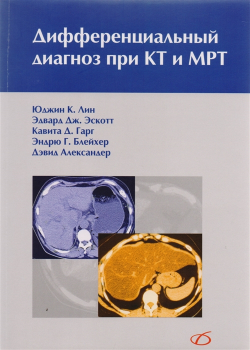 

Дифференциальный диагноз при КТ и МРТ (1619461)
