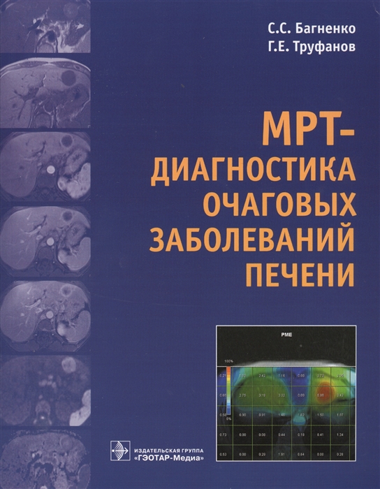 

МРТ - диагностика очаговых заболеваний печени