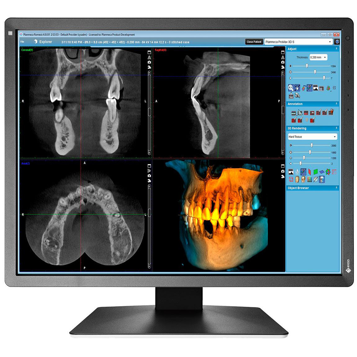 

Монитор Eizo MX216-SB (MX216-SB)