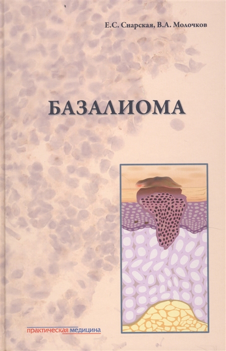 

Базалиома (1687395)