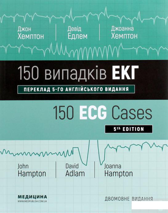 

150 випадків ЕКГ / 150 ECG Cases (1264183)
