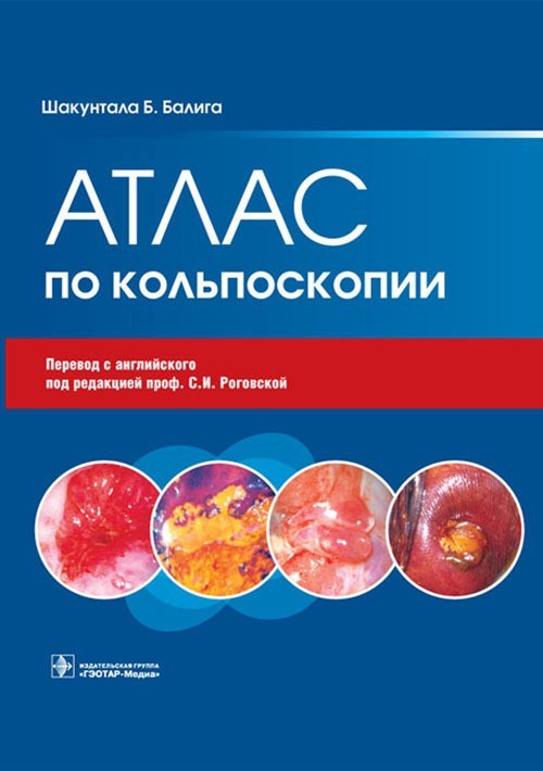 

Атлас по кольпоскопии - Балига Ш.Б. 2012 г. (978-5-9704-1932-8)