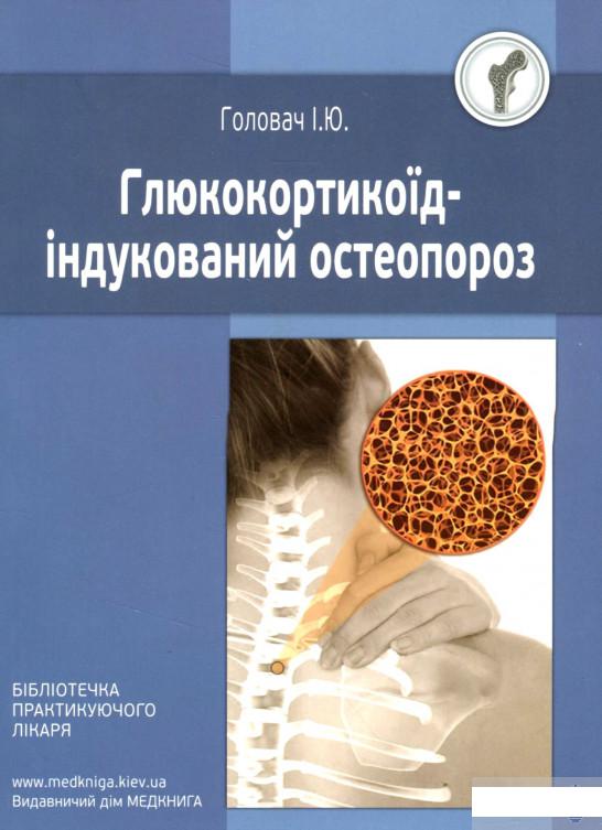 

Глюкокортикоїд-індукований остеопороз (1290701)