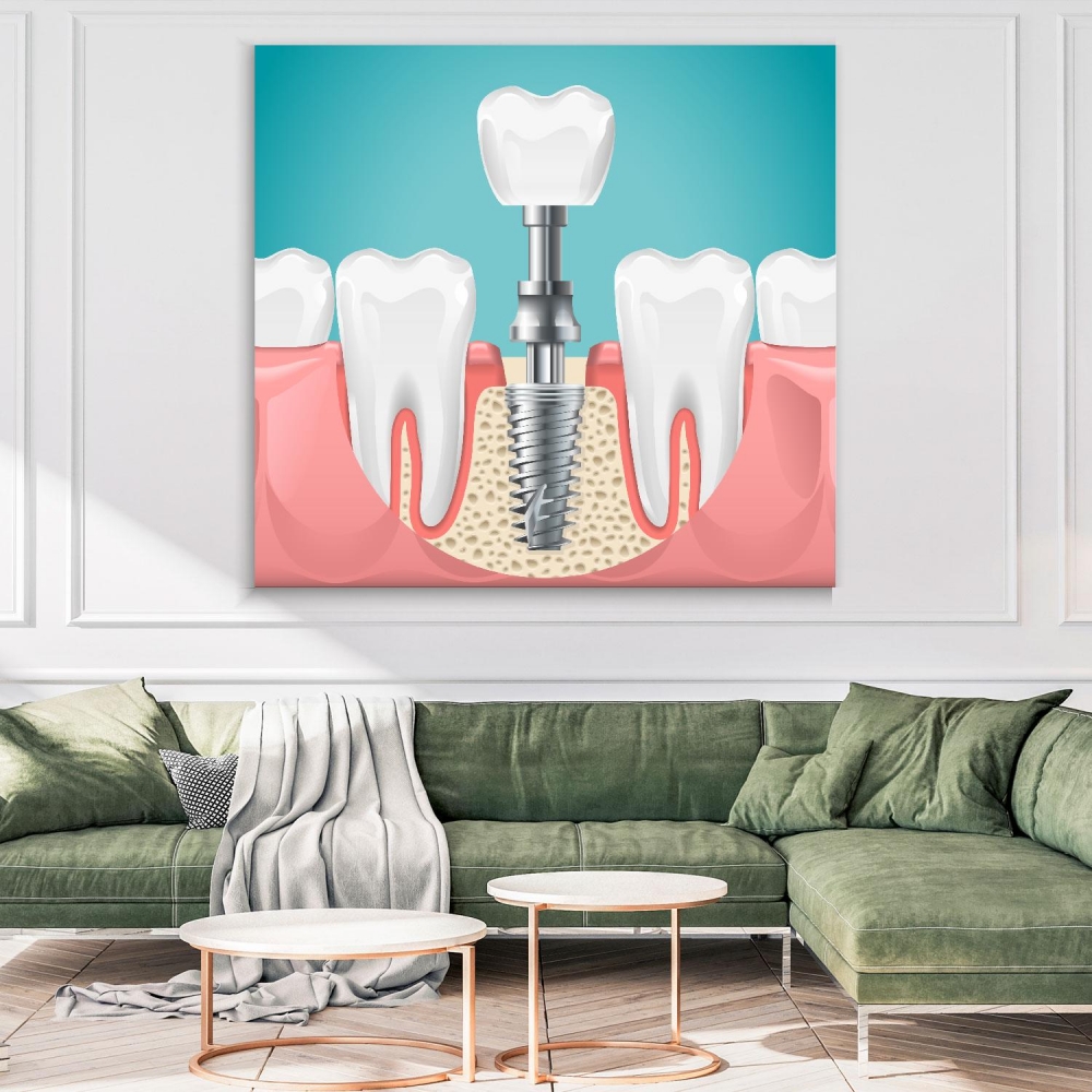 

Картина на холсте Стоматология Dental Surgery 90х90 см.