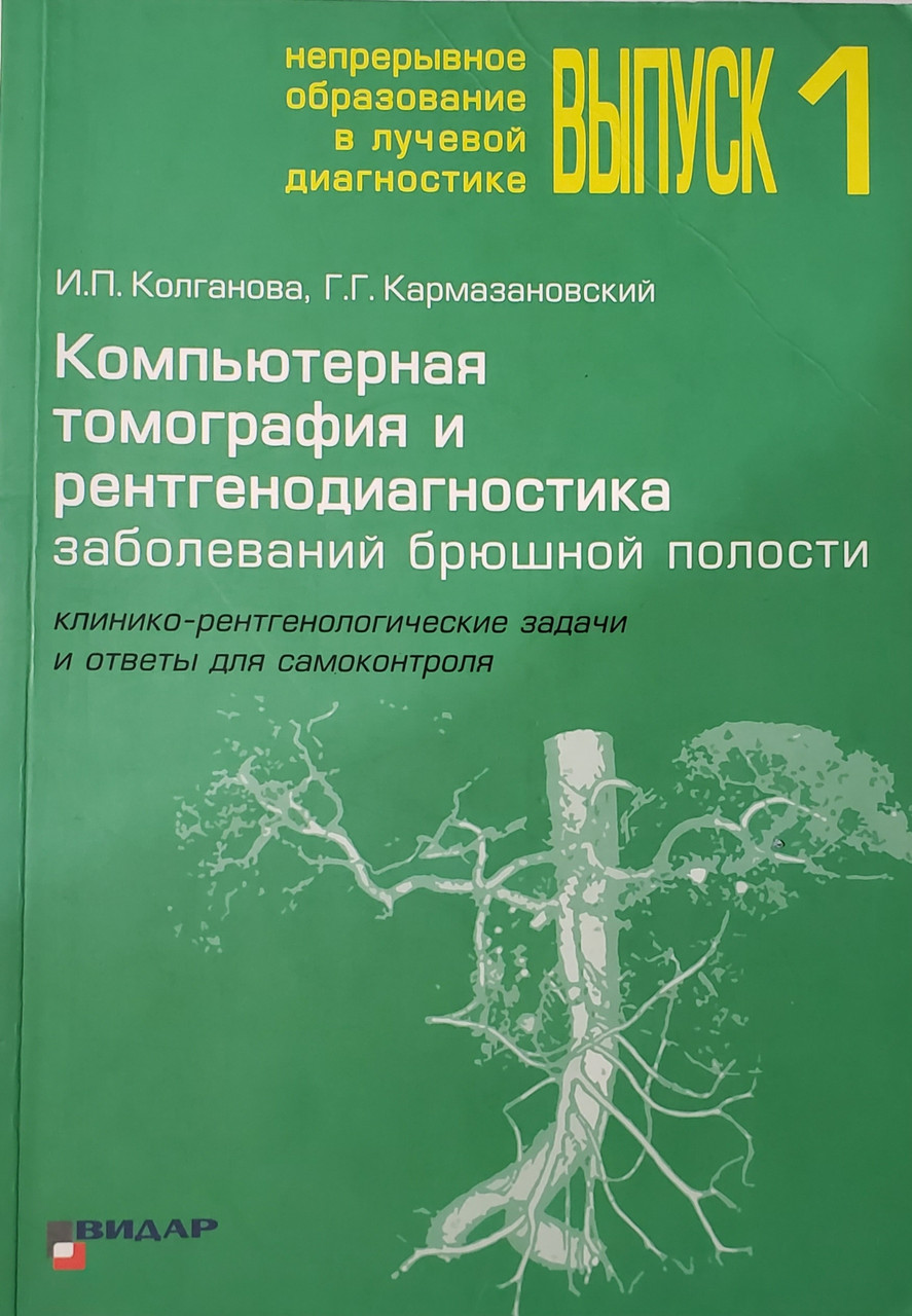 

И.П.Колганова, Кармазановский Компьютерная томография и рентгенодиагностика заболеваний брюшной полости (978-5-88429-206-2) Изд. Видар-М