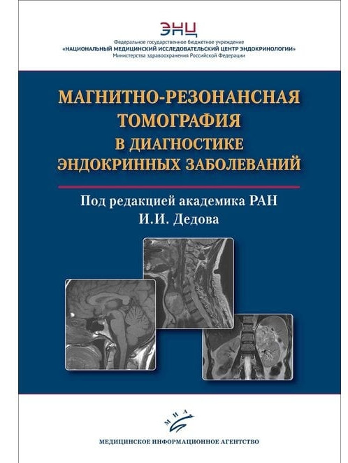 

Магнитно-резонансная томография в диагностике эндокринных 2021 (978-5-907098-48-0) Изд. Медицинское информационное агентство