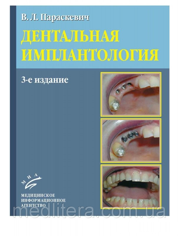 

Параскевич В. Л. Дентальная имплантология 3-е изд (978-5-8948-1743-9) Изд. Медицинское информационное агентство